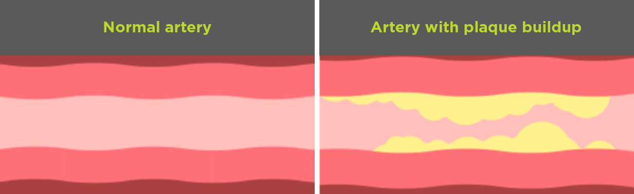 Artery diagram